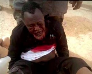 Ibrahim Yaqoub El Zakzaky is pictured bleeding as a result of the clash between the Nigerian army and his followers